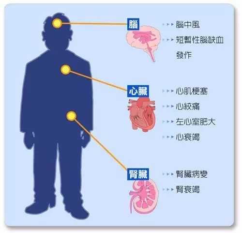 血壓分為“高壓”和“低壓”，哪個指標超標更危險？