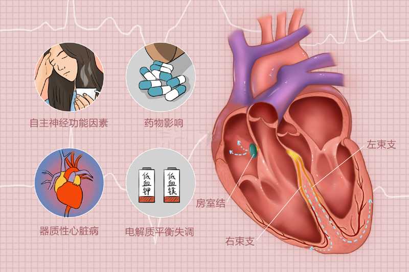 心臟早搏怎么治療，5種藥物用法要記牢！