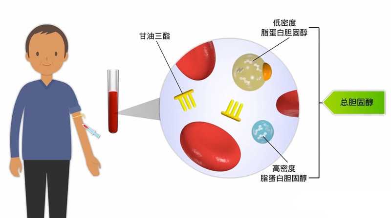 血脂超標(biāo)，需要做哪些常規(guī)檢查？