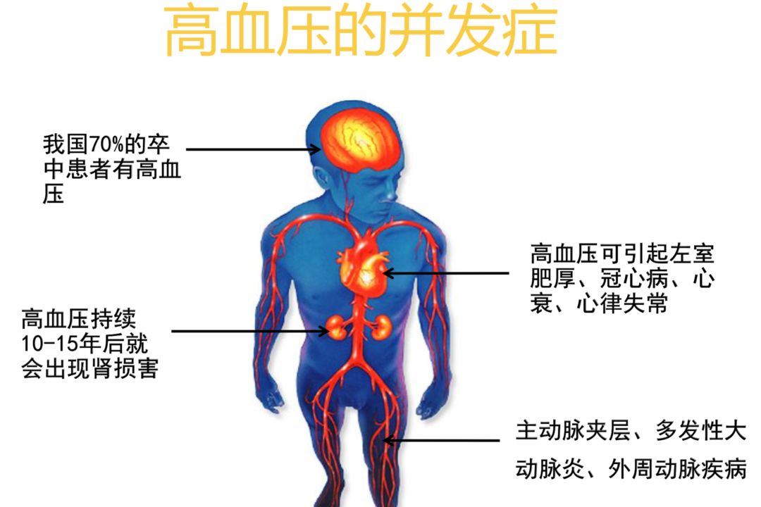 高血壓生活管理指南，涉及方方面面?。ńㄗh收藏）