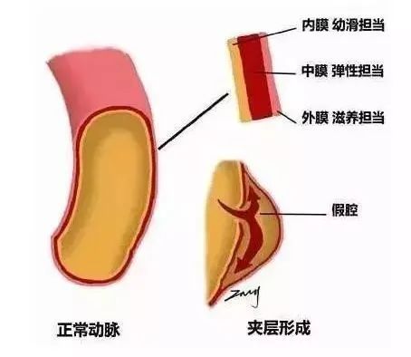 男人腎不行，更容易得高血壓！關(guān)注腎血管性高血壓癥