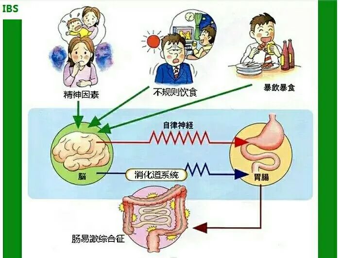 一緊張就會(huì)肚子痛，多半是腸易激綜合征