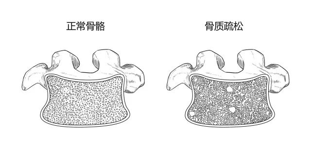 10種常見疾病的癥狀及危害！