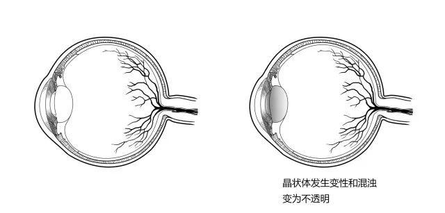 10種常見疾病的癥狀及危害！