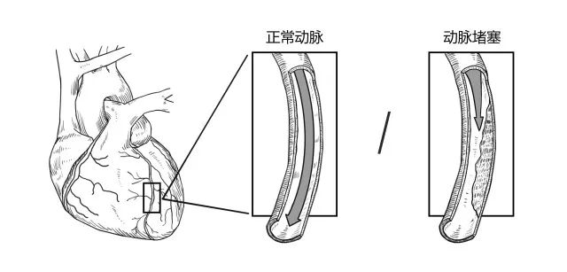 10種常見疾病的癥狀及危害！