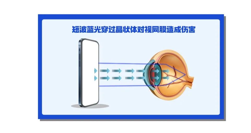 這6個(gè)日常不良習(xí)慣，會(huì)毀了眼睛！來(lái)看看你中招幾個(gè)