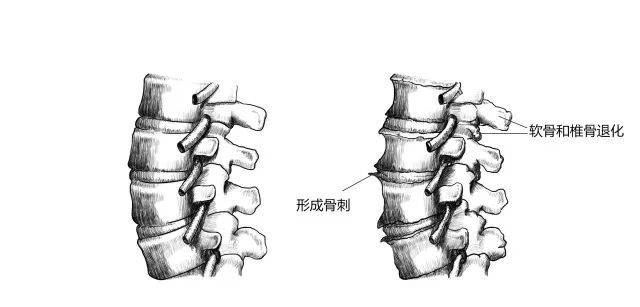 10種常見疾病的癥狀及危害！