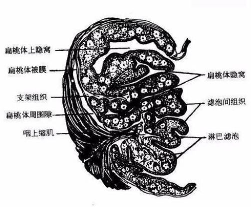 無(wú)法改善的口臭、咽喉痛，需要檢查一下你的扁桃體結(jié)石！