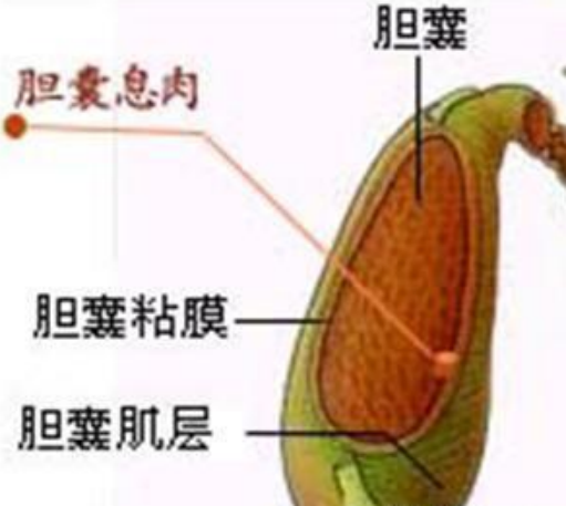 為什么會長膽囊息肉？體檢發(fā)現(xiàn)膽囊息肉該怎么辦？