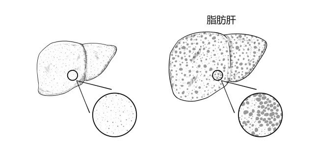 10種常見疾病的癥狀及危害！