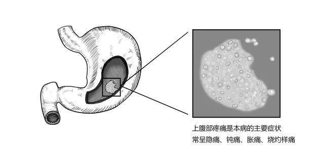 10種常見疾病的癥狀及危害！