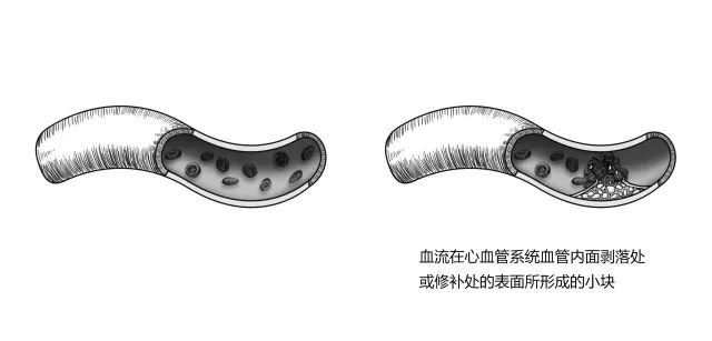 10種常見疾病的癥狀及危害！